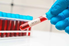 Pemantauan Diabetes Dasar di GWS Medika