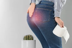Tindakan Ambeien Flash Optical Laser 2 Diagnosis di Oxymed Clinic (VWC)