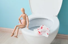 Tindakan Ambein HIV/Kondiloma Radio Frekuensi di Oxymed Clinic (VWC)