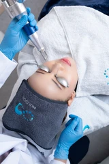 Pico Laser : Toning, Pigmentation di NULOOK Anti Aging & Regenerative Center