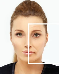 Lower Blepharoplasty di NULOOK Anti Aging & Regenerative Center