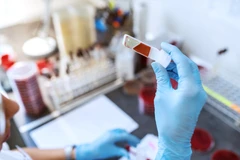 Pemeriksaan HIV/AIDS di Klinik Mega Kartika