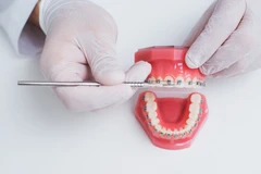 Kontrol Behel (10 kunjungan) di Klinik Mega Kartika