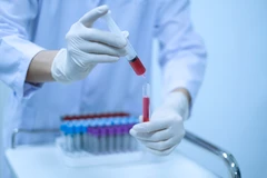 Pemeriksaan Opiate di Cata Medical Care