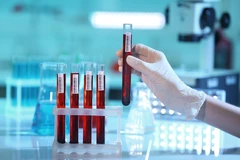 Pemeriksaan Helicobacter pylori IgM di Cata Medical Care