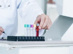 Pemeriksaan Dapur Thinprep di Cata Medical Care