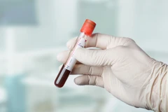 Pemeriksaan Bile Acid di Klinik Galaxy Medical Center