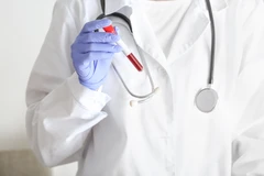 Tes Alergi Ig E Atopy Panel Indonesia (54 Allergen) di Klinik Lina Lica