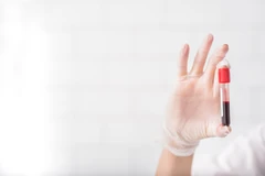 Pemerikasaan HPV DNA di Klinik Pratama Atma Jaya