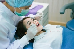 Tambalan Composite Super Premium Anterior Gigi Tetap (Sedang) di Tooth & Co Dental Clinic