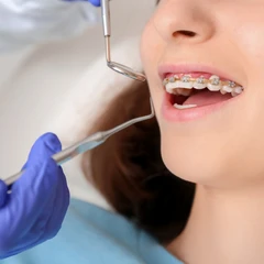 Potong Kawat Ortho di Denticle Dental Care