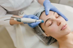 Peeling + Facial Spesifik di Devone Clinic