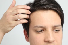 PRP Hair Growth di KAMANIYA Skin Clinic