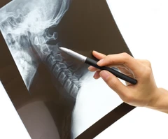 Rontgen Abdomen 2 Posisi di AIC Medical Clinic
