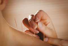 Dry Needling >10 Jahitan di AIC Physiotherapy Clinic
