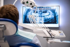 Rontgen Gigi Panoramic di Primecare Clinic