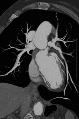 MSCT Scan Angiography Cardiac di RS Jantung Jakarta