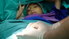 Sunat Anak Metode LEM (Tanpa Jahitan) di Klinik Kasta Gumani
