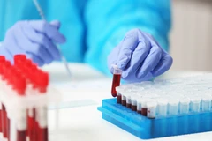 Pemeriksaan FIBRINOGEN di RS Radjak Cengkareng