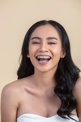 Pemasangan Behel Ceramic di Tami Dental Care