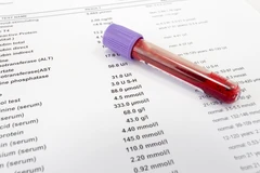 Pemeriksaan Hematologi Morfologi Darah Tepi di Emyu Healthcare