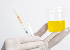 Pemeriksaan Urinalisa Urine Flowcytometri di Emyu Healthcare