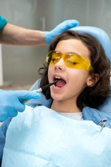 Cabut Gigi Susu Anak di Klinik Kimmi Dental Care Bintaro