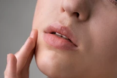 Pinky Lip Laser 1x di Aetozee Aesthetic