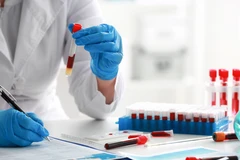 Pemeriksaan Autoimmune Anti B2GPI IgG di C-Lab