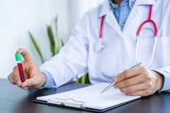 Pemeriksaan STD Chlamydia trachomatis IgG di C-Lab