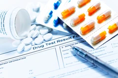 Pemeriksaan BZO/ benzodiazepine di Klinik Kita