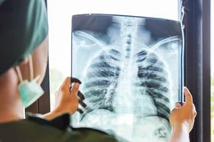 X-ray Nasal Bone di Biomedilab