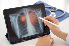 X-ray Scoliosis Control (2 Posisi) di Biomedilab