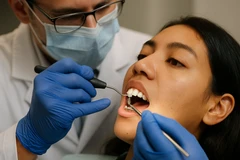 Tumpatan sementara di Beloved Dental Care