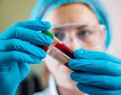 Pemeriksaan Rapid Hepatitis B di Klinik Anshani