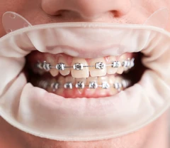 Kontrol Orthodontic di NK Health
