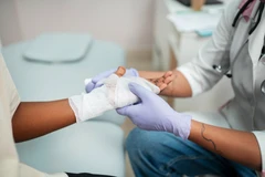 Homecare Rawat Luka Berat di Ratulangi Medical Center