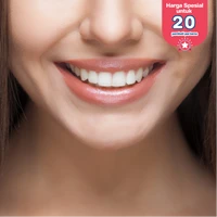 Bleaching Gigi di Empire Dental Studio