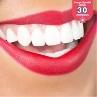 Bleaching Gigi di AM Dental Care Gading Serpong