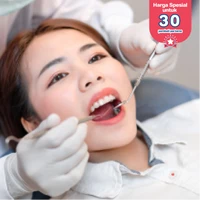 Gingival Depigmentation 1X di Klinik Tooth Signature