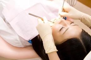 Scaling Gigi + Stain Removal di Edental