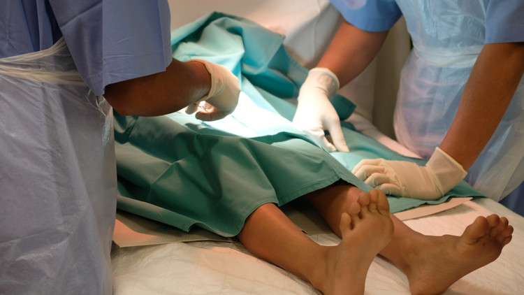 Sunat Dewasa Konvensional atau Laser di Klinik Ammyn Sukabumi