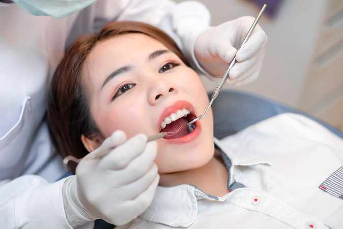 Direct Veneer Composite 1 Gigi di Rainbow Dental Care