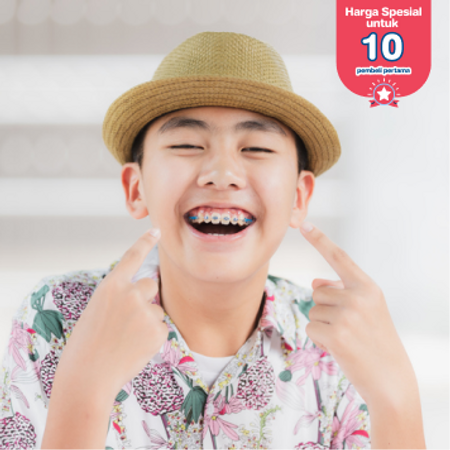 Pemasangan Behel Sapphire oleh drg. Spesialis Ortodontis di Dentistique Clinic