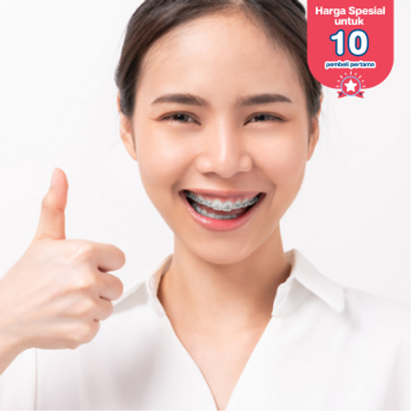 Pemasangan Behel Self Ligating di Empire Dental Studio