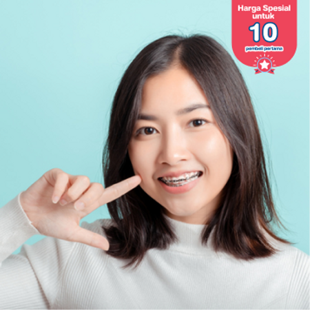 Pemasangan Behel Metal oleh drg. Umum di Mydentismile