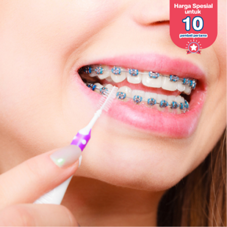 Pemasangan Behel Metal oleh drg. Spesialis Ortodontis di Klinik Gigi Griya Denta