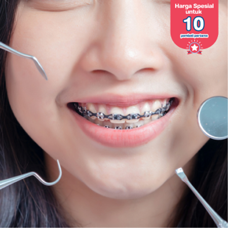 Pemasangan Behel Metal oleh drg. Umum di AM Dental Care Gading Serpong