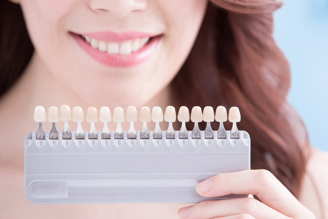 Veneer Direct Composite 1 Gigi di RRDC Dental Care