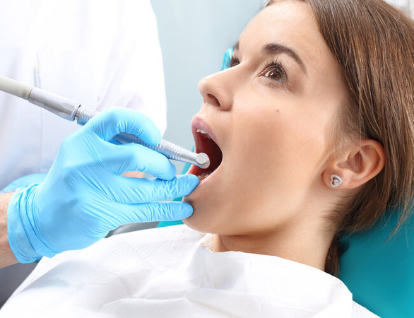 Scaling & Polishing Gigi Atas dan Bawah di RRDC Dental Care